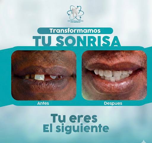 Transformación dental - Transformamos Tu Sonrisa